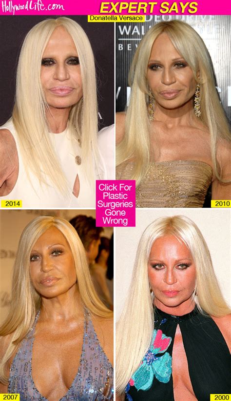 versace wiki donatella|what happened to donatella versace's face.